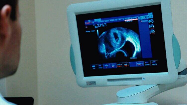 孕检B超影像
