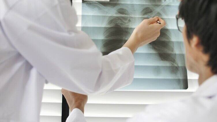 两名医生在医院分析肺部x光片