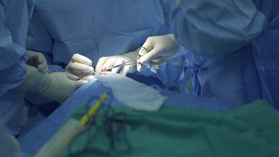 4K外科医生在手术室手术