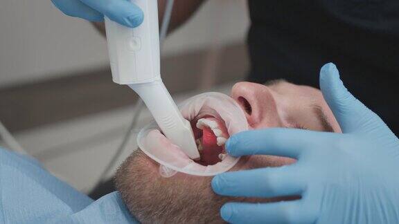 特写:在诊所的医务室里医生正在给一名男性病人扫描牙齿牙医手里拿着一个用于下巴和嘴巴的手动3D扫描仪牙齿健康