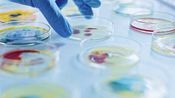 科学家使用培养皿与各种细菌组织和血液样本抗生素药物研究用DNA增强药物治疗疾病移动特写宏