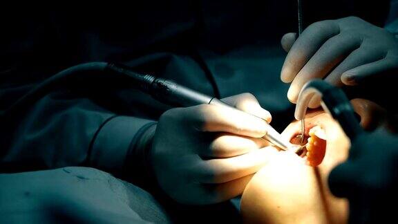 牙科医生正在给病人补牙