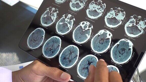 脑X线影像