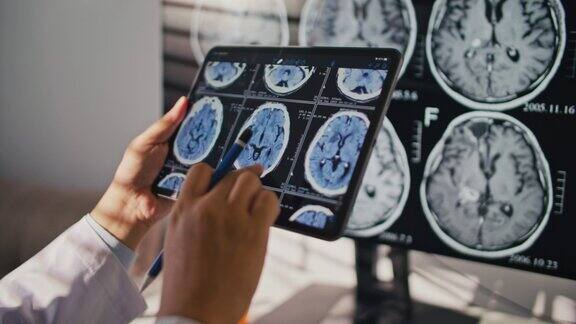 医生用数码平板电脑检查病人胸部x光脑部扫描图像