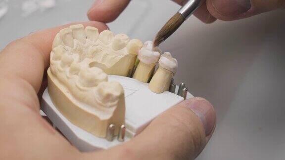 用陶瓷珐琅质覆盖牙齿制作义齿的近景