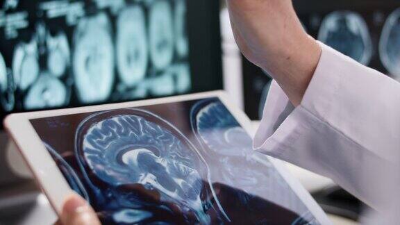高级医师在数码平板上分析MRI扫描