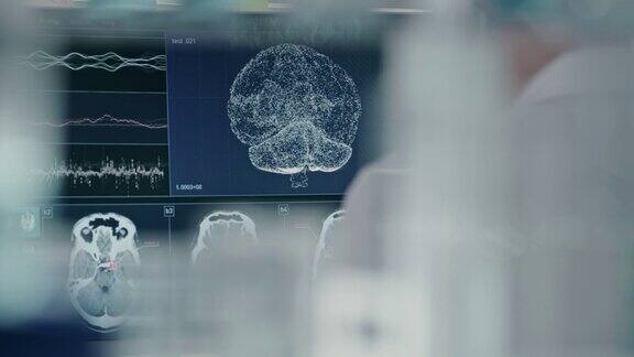 科学家在实验室电脑屏幕上的大脑模型研究
