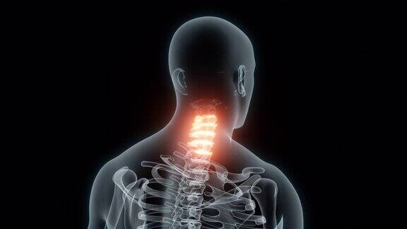 颈椎医学动画的3D渲染颈椎x光片