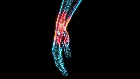 3D可视化数字x射线的人的手与疼痛脉冲在形式的红色未来的现代医学发现健康问题的现代技术手腕部疼痛感觉的可视化
