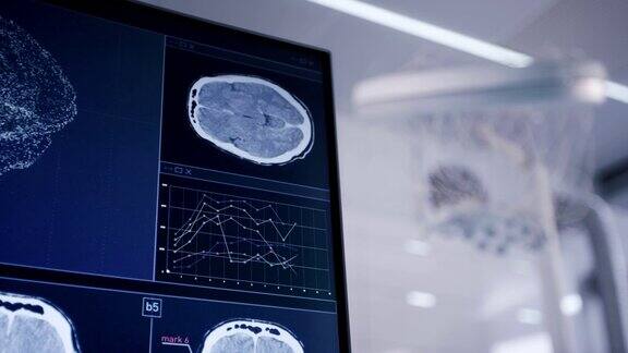 实验室设备脑电波扫描耳机和计算机屏幕上的脑电波研究
