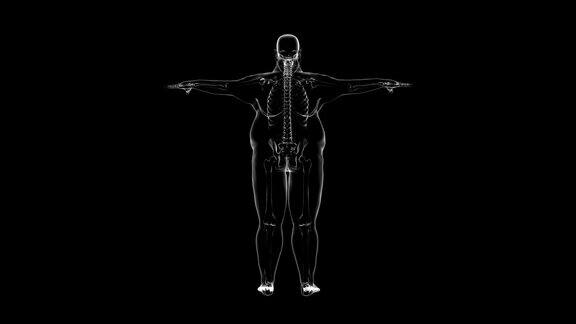 骨骼超重男子的x光片