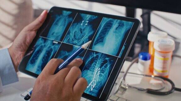 医生正在给她的病人分析平板电脑上的脑部扫描结果