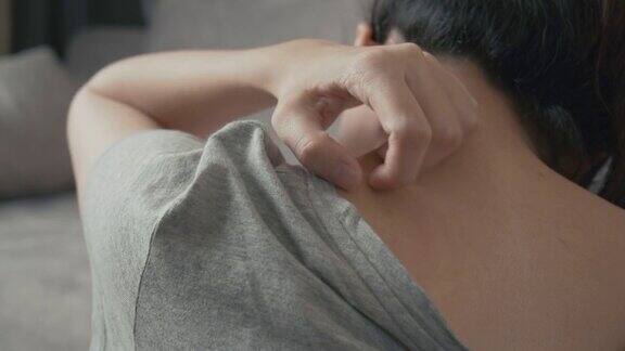 4k分辨率亚洲女人用她的手抓他痒的脖子医疗保健和医疗理念湿疹皮肤