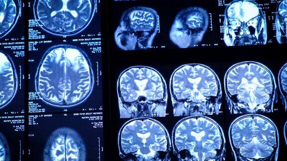 脑部CT扫描特写医学科学和教育MRI脑背景磁共振成像断层扫描枪