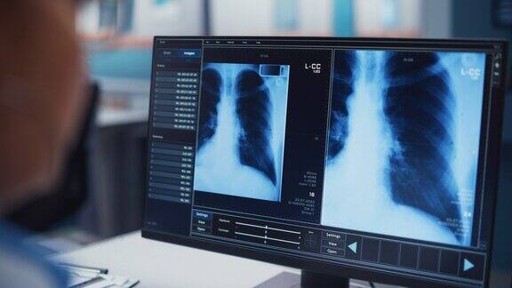 医院实验室:黑人女医生正在用电脑分析屏幕上的x射线从事疾病预防和治疗的非裔美国医生特写架焦点在肩膀上