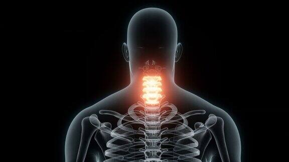 颈椎医学动画的3D渲染颈椎x光片