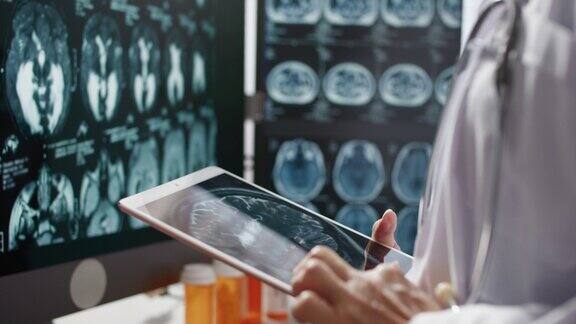 医生使用数字平板分析CTMRI脑部扫描图像