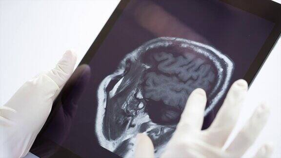 医生在平板电脑上检查图像x射线MRI