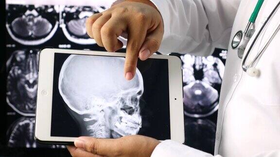 医生正在展示脑部计算机断层扫描的x光图像