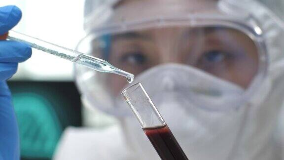 科学家在实验室将血样从移液管转移到显微镜载玻片上冠状病毒COVID-19检测新型冠状病毒