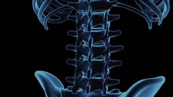 腰椎身体x线扫描的脊柱下带