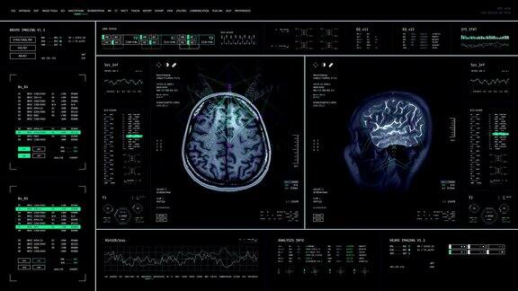 MRI软件脑部扫描GUI
