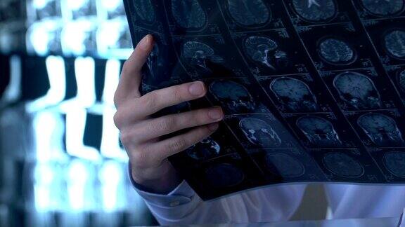 实习医师分析大脑x光图像学生解剖研究神经学