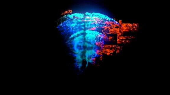 故障损坏破损的旋转MRI扫描人类大脑与发光的蓝色和橙色颗粒循环药物的镜头