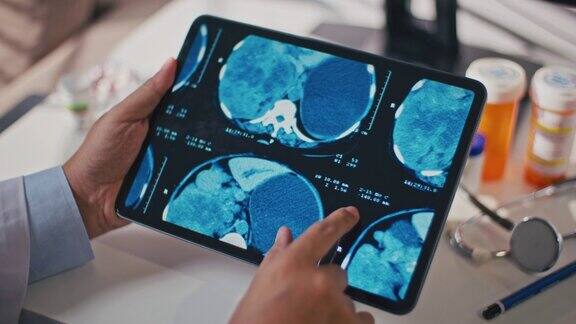 医生正在给她的病人分析平板电脑上的脑部扫描结果