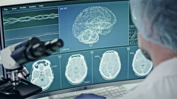 科学家在显微镜电脑屏幕上的脑电波扫描研究