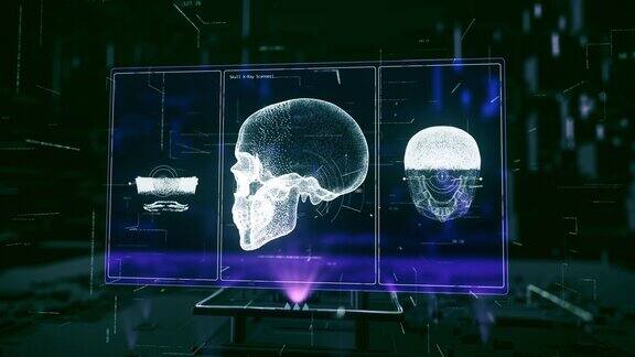 人体颅骨x射线医学扫描仪