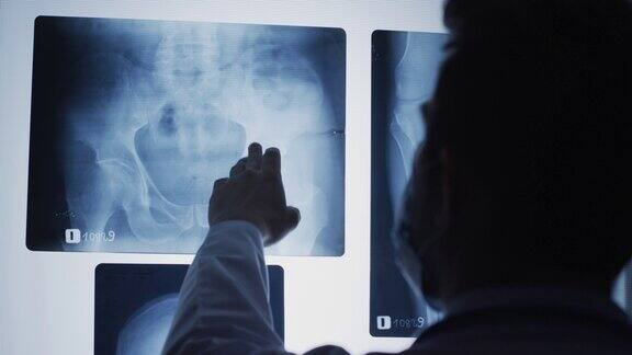 骨盆x光片分析