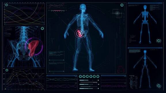 未来实验室屏幕与动画人体模型扫描虚拟病人的损伤臀部有红色斑纹