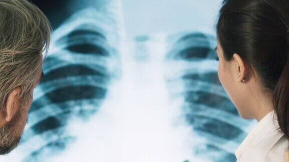 科学家正在观察感染冠状病毒的人肺部的x光片关闭了