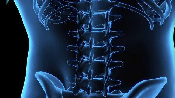腰椎的3D计算机断层扫描和腰椎的x光片显示从高处坠落后的胸腰椎骨折的创伤医务人员
