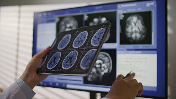 医生在数码平板上分析MRI扫描