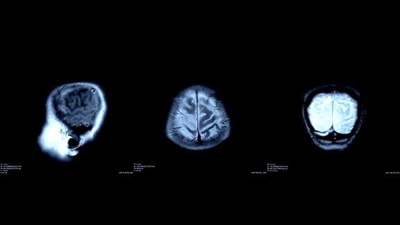 大脑扫描图像