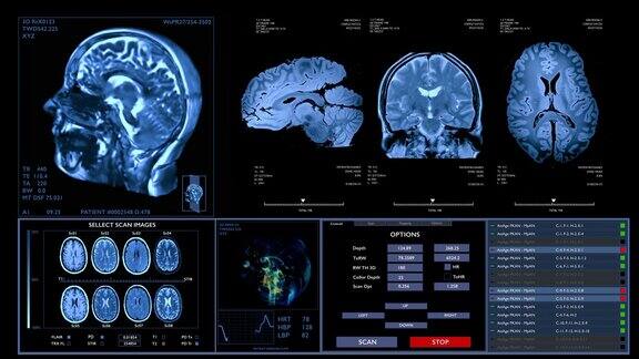 磁共振大脑扫描动画神经学数据生命体征显示未来科技HUD界面概念