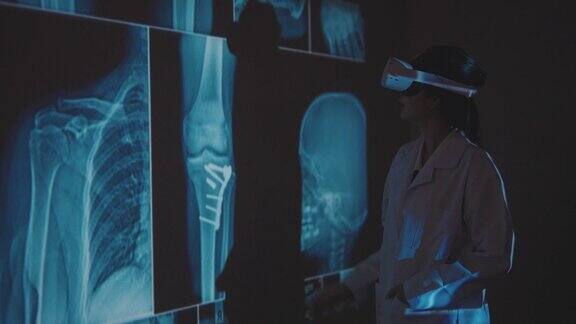 一位女医生看病人的膝盖x光诊断