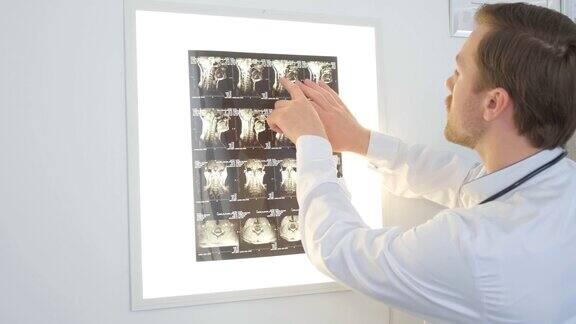 在医院里一位专业的脊椎学家正在检查一位女病人脊柱的x光片