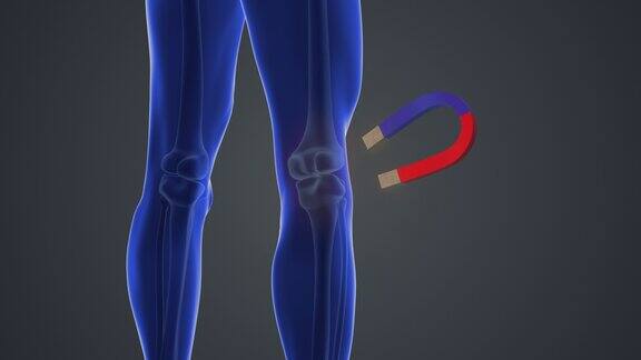 磁铁治疗膝关节疼痛