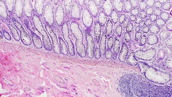 人体直肠组织在显微镜下对亮场放大100倍