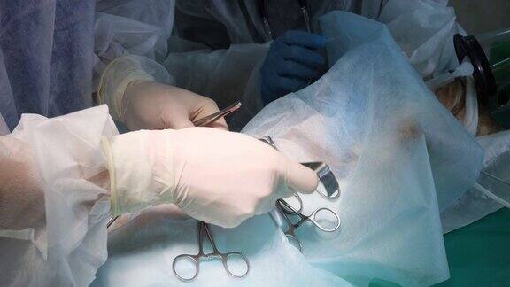 外科医生的手在手术室里进行复杂的外科手术特写镜头