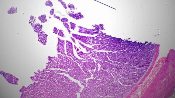 人大肠切片在显微镜下放大40倍