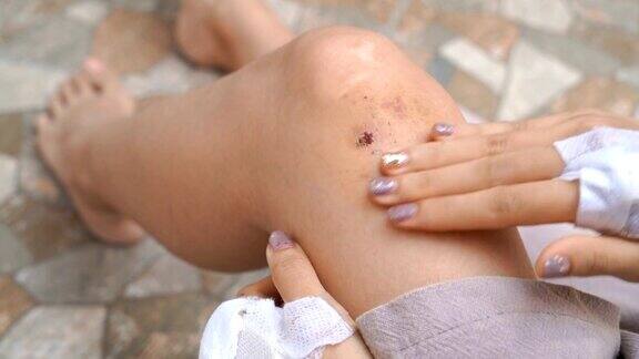 一个女人正在给她膝盖上的疮痂涂药膏