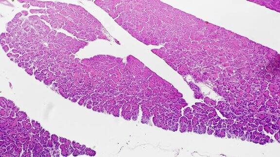 人体胰腺组织切片在100倍显微镜下明光放大