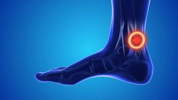 足部穴位按摩缓解脚踝和脚后跟疼痛