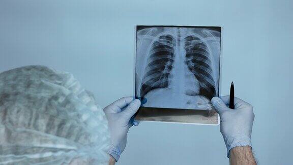 特写医生手里拿着笔在手术室里给肺部拍x光片医生在医院里仔细分析病人肺部的x光片超声显示肺损伤肺炎健康