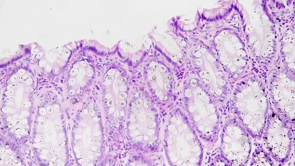 人体直肠组织在显微镜下对亮场放大200倍