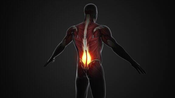 纤维肌痛或背部疼痛的医疗条件